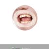SEPARADOR DE LABIOS CON BARRERA DE GOMA